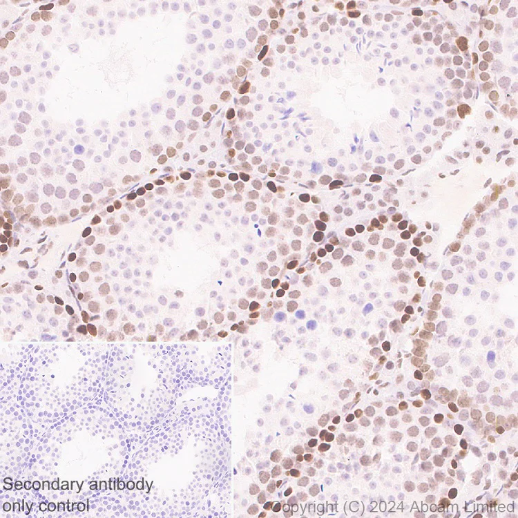 Immunohistochemistry (Formalin/PFA-fixed paraffin-embedded sections) - Anti-Brd4 antibody [EPR29186-23] (AB322063)