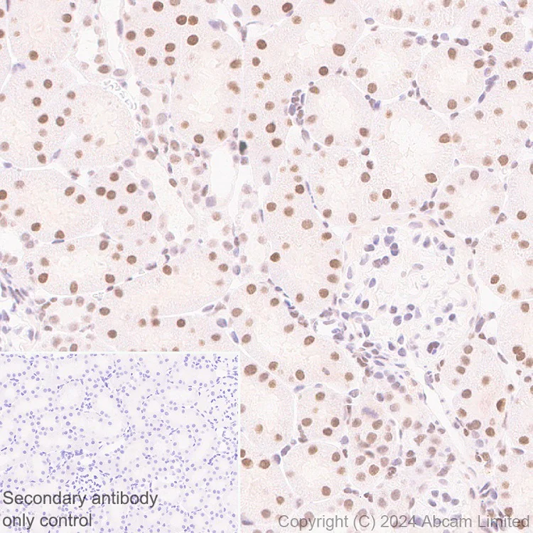 Immunohistochemistry (Formalin/PFA-fixed paraffin-embedded sections) - Anti-Brd4 antibody [EPR29186-23] (AB322063)