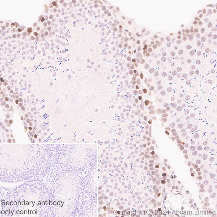 Immunohistochemistry (Formalin/PFA-fixed paraffin-embedded sections) - Anti-Brd4 antibody [EPR29186-23] (AB322063)
