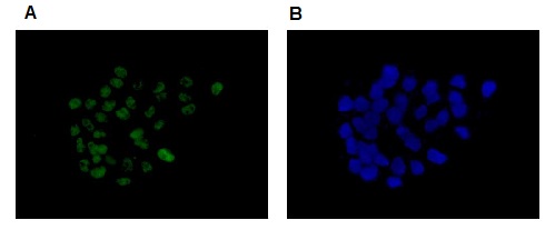 Immunocytochemistry/ Immunofluorescence - Anti-Brd4 antibody [EPR5150(2)] (ab128874), expandable thumbnail