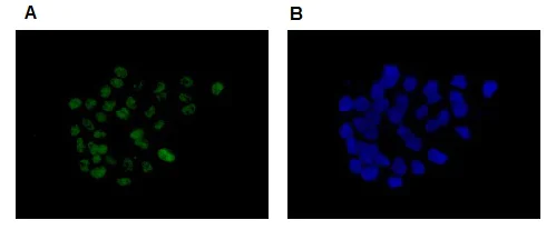 Immunocytochemistry/ Immunofluorescence - Anti-Brd4 antibody [EPR5150(2)] (AB128874)