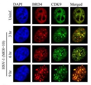 Immunocytochemistry/ Immunofluorescence - Anti-Brd4 antibody [EPR5150(2)] (AB128874), expandable thumbnail