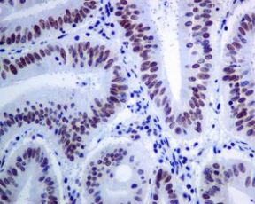 Immunohistochemistry (Formalin/PFA-fixed paraffin-embedded sections) - Anti-Brd4 antibody [EPR5150(2)] (AB128874), expandable thumbnail