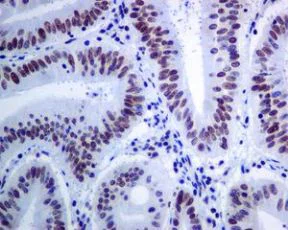Immunohistochemistry (Formalin/PFA-fixed paraffin-embedded sections) - Anti-Brd4 antibody [EPR5150(2)] (AB128874)