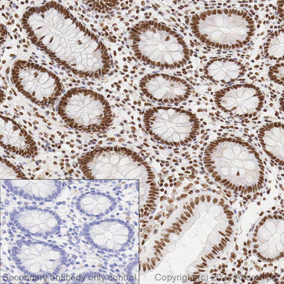 Immunohistochemistry (Formalin/PFA-fixed paraffin-embedded sections) - Anti-Brd4 antibody [EPR5150(2)] (ab128874), expandable thumbnail