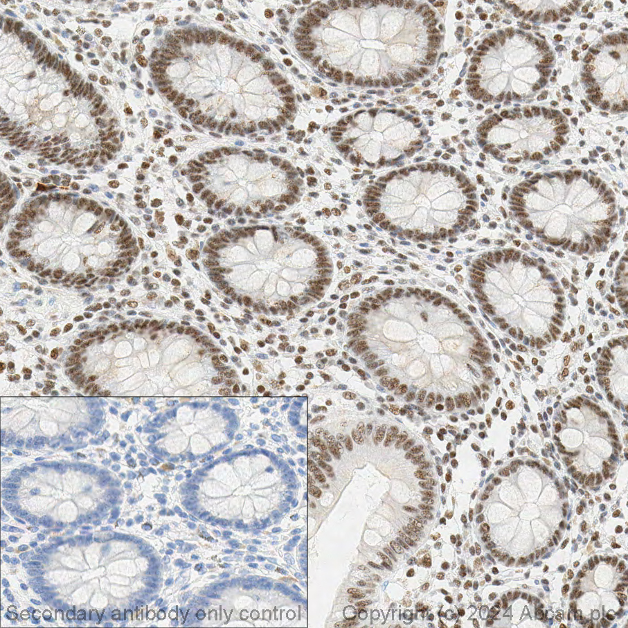 Immunohistochemistry (Formalin/PFA-fixed paraffin-embedded sections) - Anti-Brd4 antibody [EPR5150(2)] (ab128874), expandable thumbnail