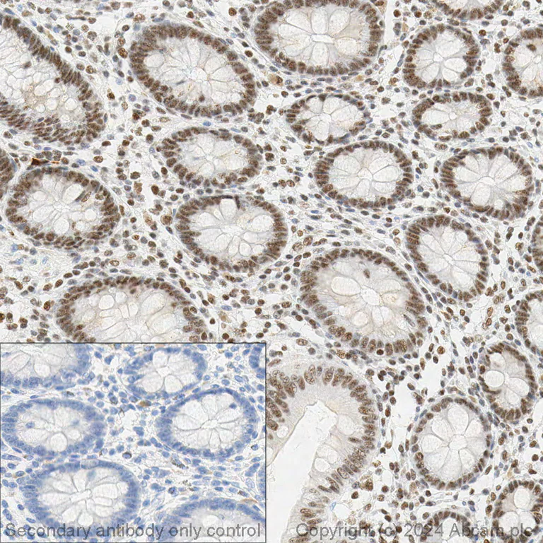 Immunohistochemistry (Formalin/PFA-fixed paraffin-embedded sections) - Anti-Brd4 antibody [EPR5150(2)] (AB128874)