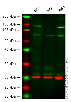 Western blot - Anti-Brd4 antibody [EPR5150(2)] (AB128874), expandable thumbnail