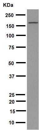 Western blot - Anti-Brd4 antibody [EPR5150(2)] (ab128874), expandable thumbnail