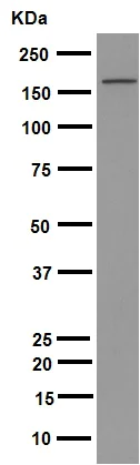 Western blot - Anti-Brd4 antibody [EPR5150(2)] (AB128874)