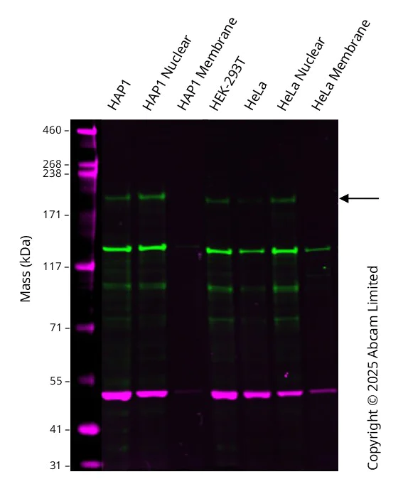 Western blot - Anti-Brd4 antibody [EPR5150(2)] (AB128874)