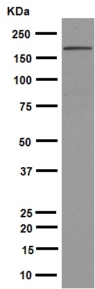 Western blot - Anti-Brd4 antibody [EPR5150(2)] (ab128874), expandable thumbnail