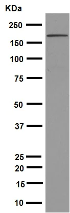 Western blot - Anti-Brd4 antibody [EPR5150(2)] (AB128874)