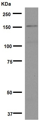 Western blot - Anti-Brd4 antibody [EPR5150(2)] (ab128874), expandable thumbnail