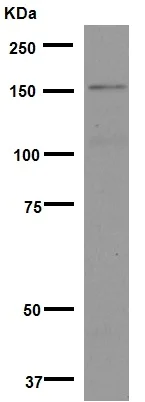 Western blot - Anti-Brd4 antibody [EPR5150(2)] (AB128874)