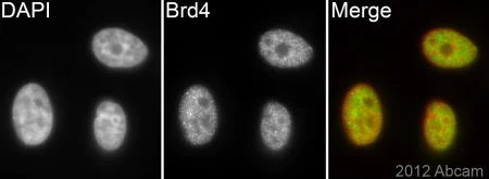Immunocytochemistry/ Immunofluorescence - Anti-Brd4 antibody [EPR5150(2)] - BSA and Azide free (AB182446)