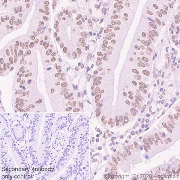 Immunohistochemistry (Formalin/PFA-fixed paraffin-embedded sections) - Anti-BRD7 antibody [2D3] (AB252820)
