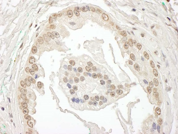 Immunohistochemistry (Formalin/PFA-fixed paraffin-embedded sections) - Anti-BRD7 antibody (AB245599)