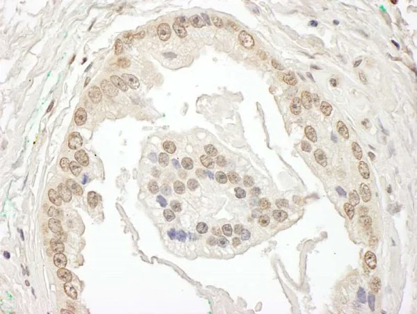 Immunohistochemistry (Formalin/PFA-fixed paraffin-embedded sections) - Anti-BRD7 antibody (AB245599)