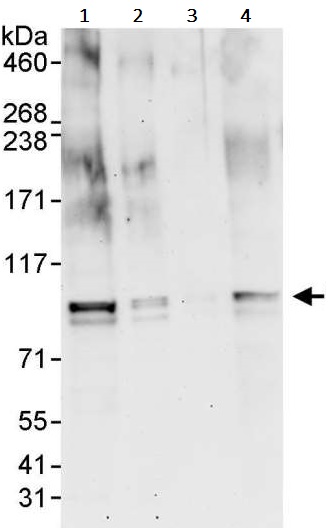 Western blot - Anti-BRD7 antibody (AB245599)