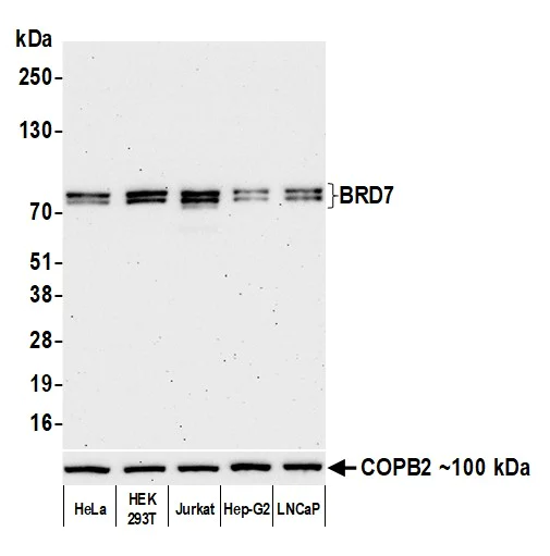Western blot - Anti-BRD7 antibody [BLR220K] - BSA free (AB314049)
