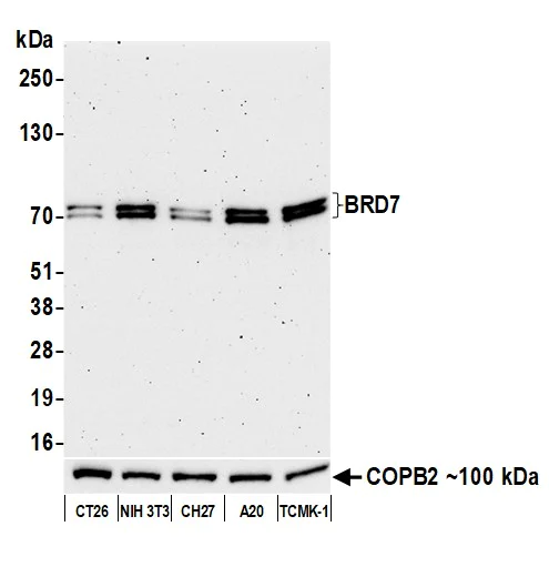 Western blot - Anti-BRD7 antibody [BLR220K] - BSA free (AB314049)