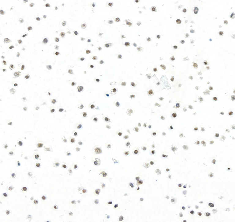 Immunocytochemistry - Anti-BRD7 antibody [BLR221K] - BSA free (AB314048)