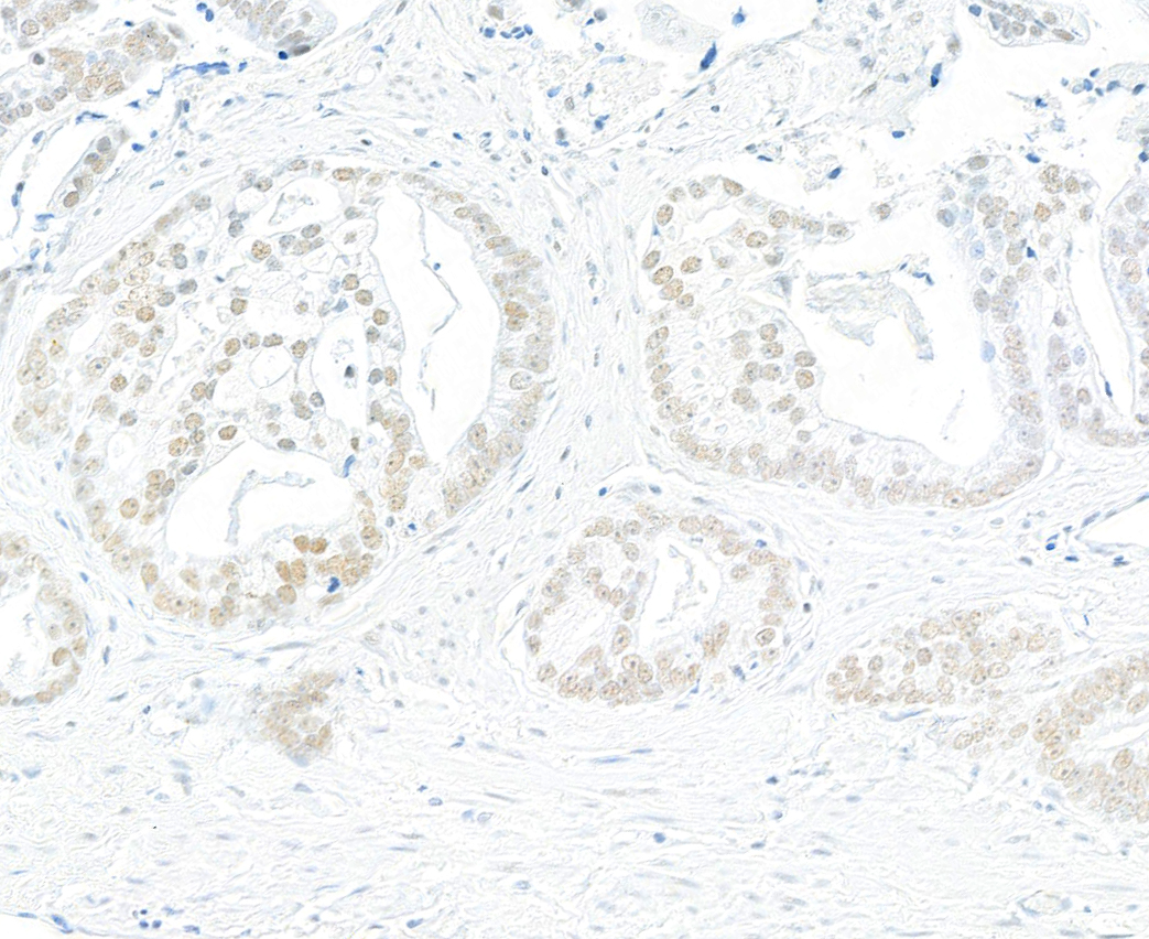 Immunohistochemistry (Formalin/PFA-fixed paraffin-embedded sections) - Anti-BRD7 antibody [BLR221K] - BSA free (AB314048), expandable thumbnail