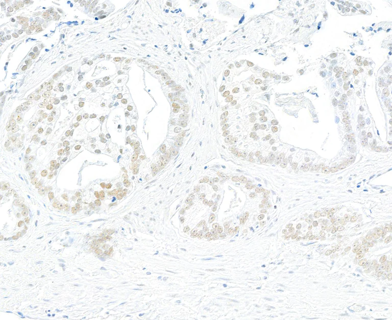 Immunohistochemistry (Formalin/PFA-fixed paraffin-embedded sections) - Anti-BRD7 antibody [BLR221K] - BSA free (AB314048)
