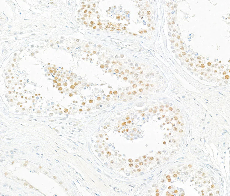 Immunohistochemistry (Formalin/PFA-fixed paraffin-embedded sections) - Anti-BRD7 antibody [BLR221K] - BSA free (AB314048)