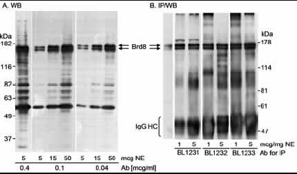 Western blot - Anti-BRD8/p120 antibody (AB17968)