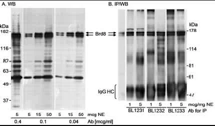 Western blot - Anti-BRD8/p120 antibody (AB17968)