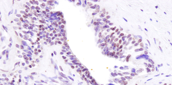 Immunohistochemistry (Formalin/PFA-fixed paraffin-embedded sections) - Anti-BRD8/p120 antibody (AB17969), expandable thumbnail