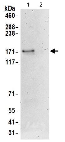 Immunoprecipitation - Anti-BRD8/p120 antibody (AB17969), expandable thumbnail