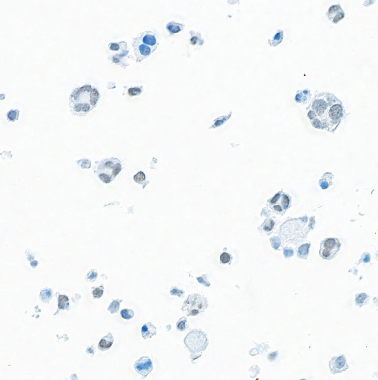 Immunocytochemistry - Anti-BRD9 antibody [BLR153J] - BSA free (AB314091)