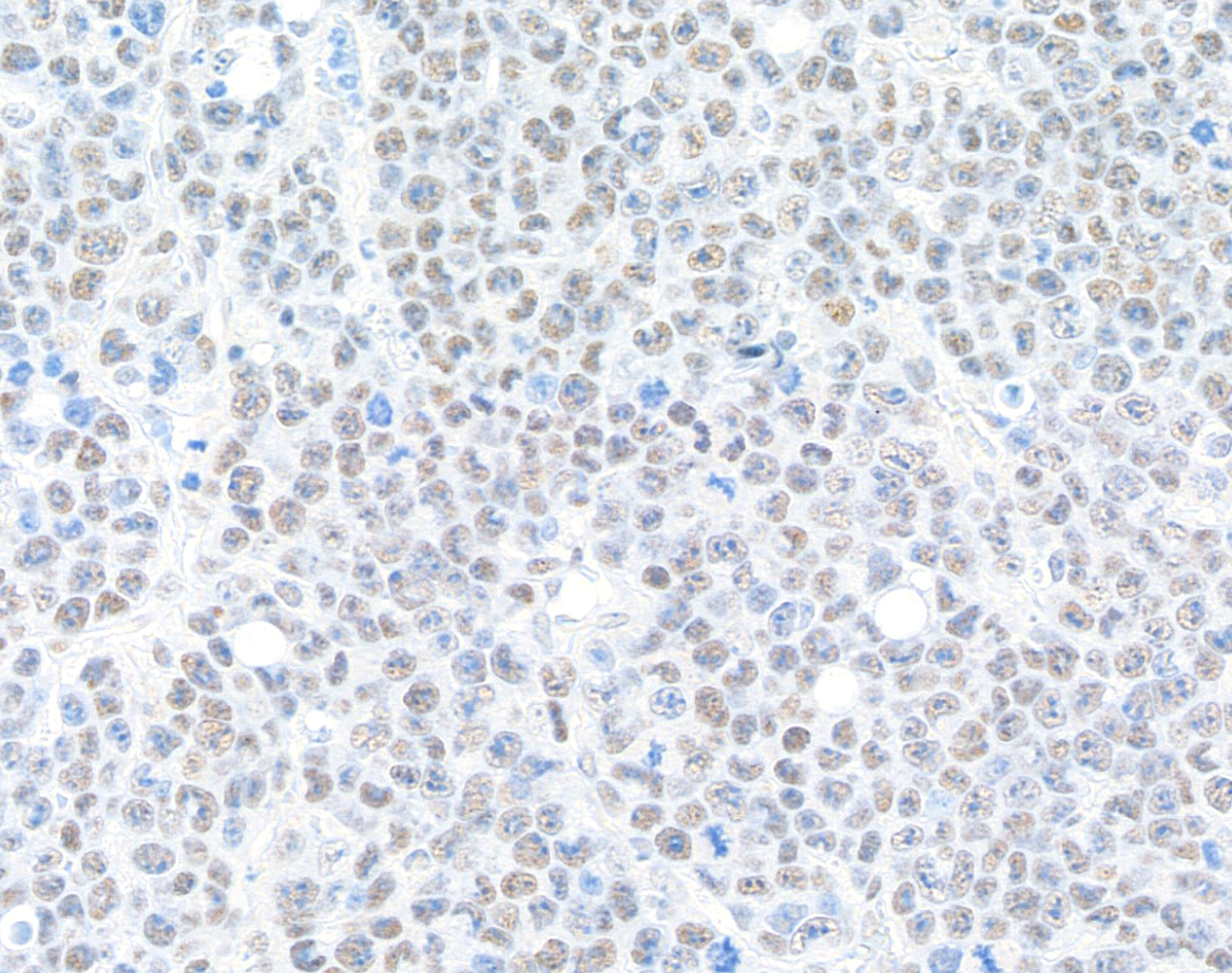 Immunohistochemistry (Formalin/PFA-fixed paraffin-embedded sections) - Anti-BRD9 antibody [BLR153J] - BSA free (ab314091), expandable thumbnail