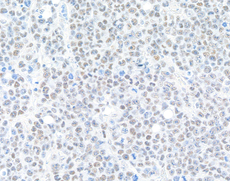 Immunohistochemistry (Formalin/PFA-fixed paraffin-embedded sections) - Anti-BRD9 antibody [BLR153J] - BSA free (AB314091)