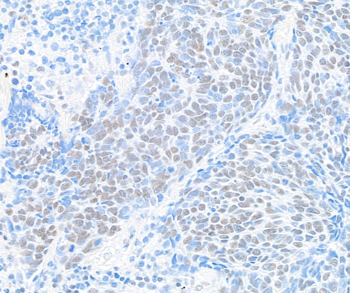 Immunohistochemistry (Formalin/PFA-fixed paraffin-embedded sections) - Anti-BRD9 antibody [BLR153J] - BSA free (ab314091), expandable thumbnail