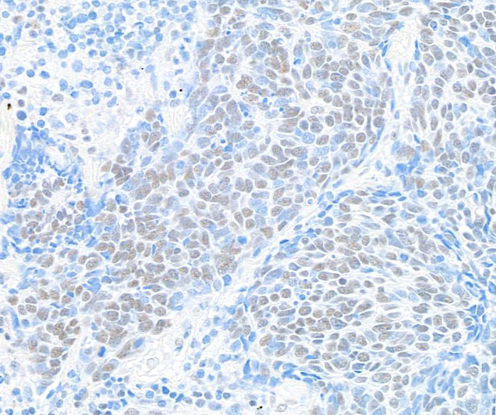 Immunohistochemistry (Formalin/PFA-fixed paraffin-embedded sections) - Anti-BRD9 antibody [BLR153J] - BSA free (AB314091)