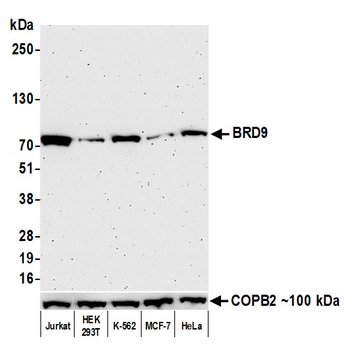Western blot - Anti-BRD9 antibody [BLR153J] - BSA free (AB314091), expandable thumbnail