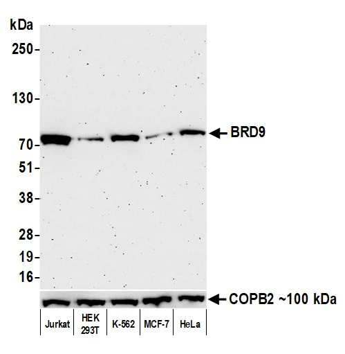 Western blot - Anti-BRD9 antibody [BLR153J] - BSA free (AB314091)
