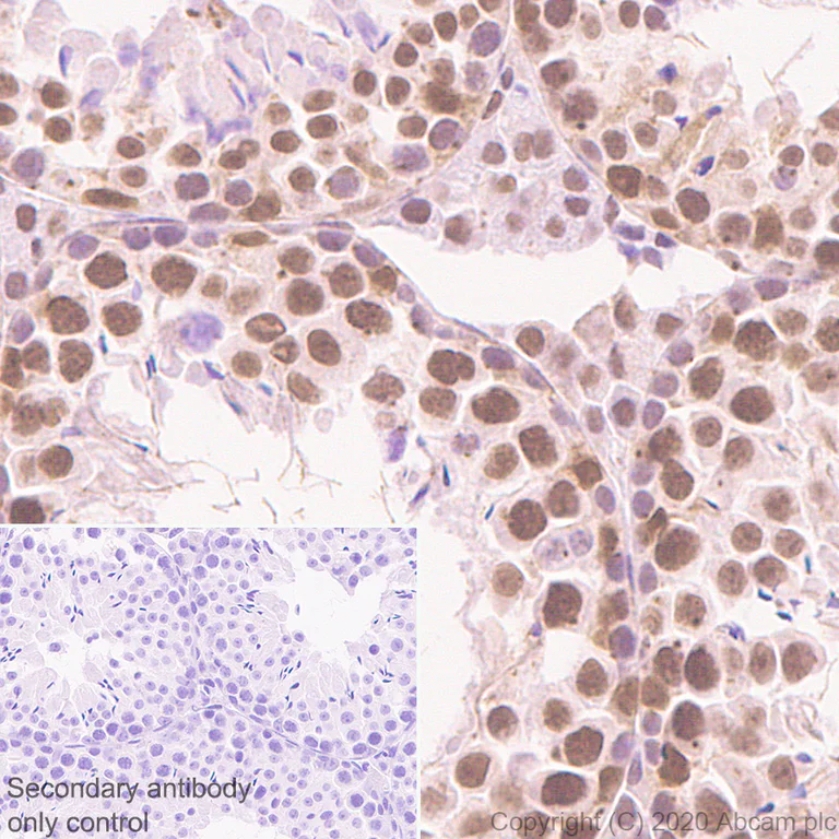 Immunohistochemistry (Formalin/PFA-fixed paraffin-embedded sections) - Anti-BRD9 antibody [EPR23888-5] - BSA and Azide free (AB277488)