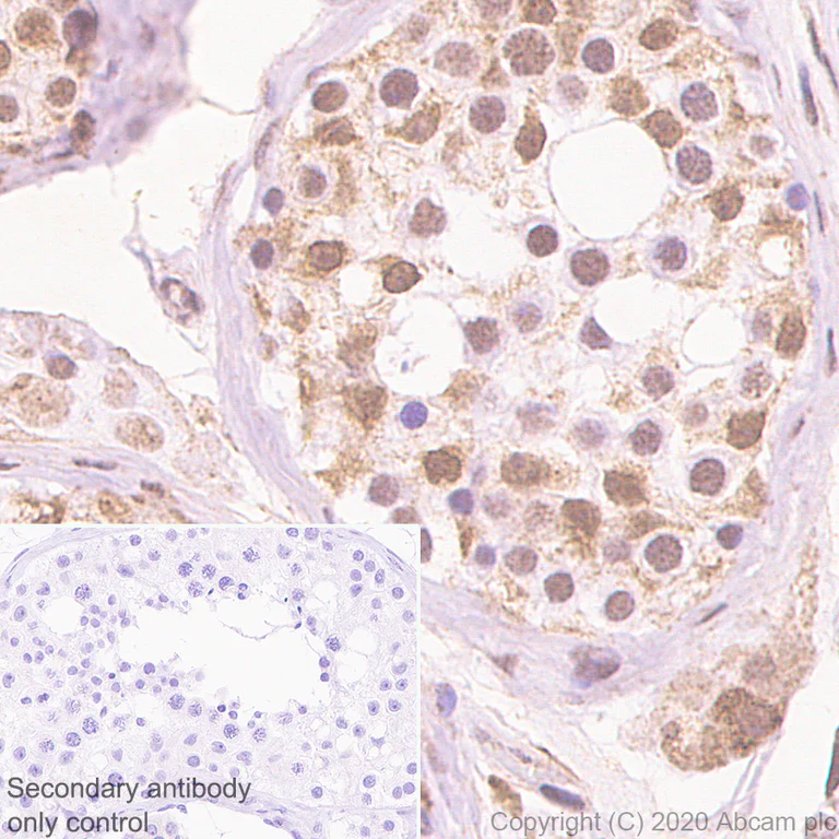 Immunohistochemistry (Formalin/PFA-fixed paraffin-embedded sections) - Anti-BRD9 antibody [EPR23888-5] - BSA and Azide free (AB277488)