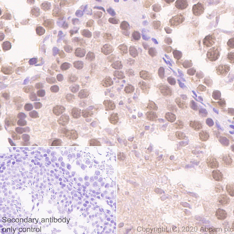 Immunohistochemistry (Formalin/PFA-fixed paraffin-embedded sections) - Anti-BRD9 antibody [EPR23888-5] - BSA and Azide free (AB277488)