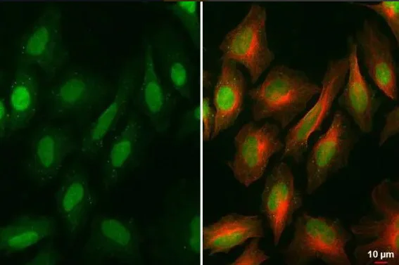 Immunocytochemistry/ Immunofluorescence - Anti-BRD9 antibody [HL1282] - BSA and Azide free (AB313843)