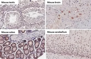 Immunohistochemistry (Formalin/PFA-fixed paraffin-embedded sections) - Anti-BRD9 antibody [HL1282] - BSA and Azide free (AB313843)