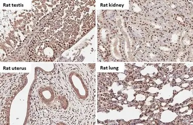 Immunohistochemistry (Formalin/PFA-fixed paraffin-embedded sections) - Anti-BRD9 antibody [HL1282] - BSA and Azide free (AB313843), expandable thumbnail