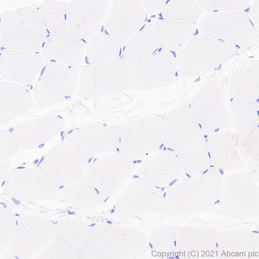 Immunohistochemistry (Formalin/PFA-fixed paraffin-embedded sections) - Anti-BRDT antibody [EPR25427-24] (AB288435), expandable thumbnail