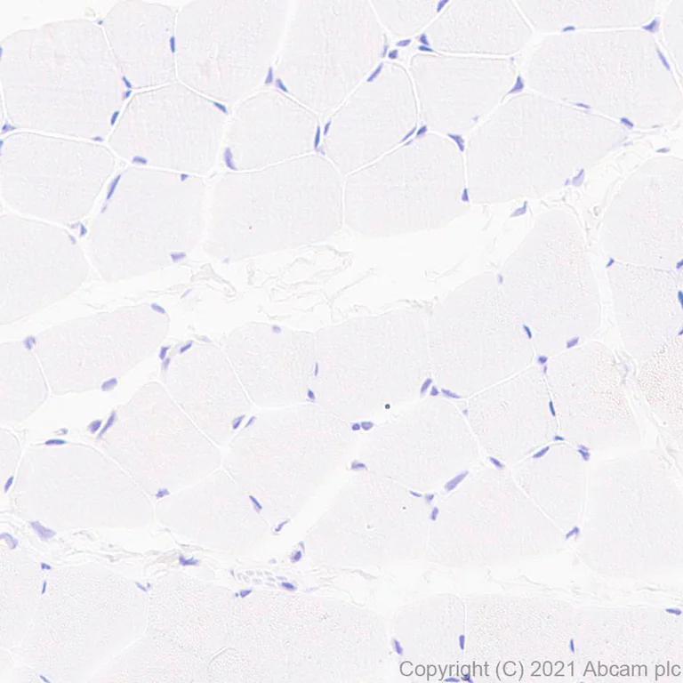 Immunohistochemistry (Formalin/PFA-fixed paraffin-embedded sections) - Anti-BRDT antibody [EPR25427-24] (AB288435)