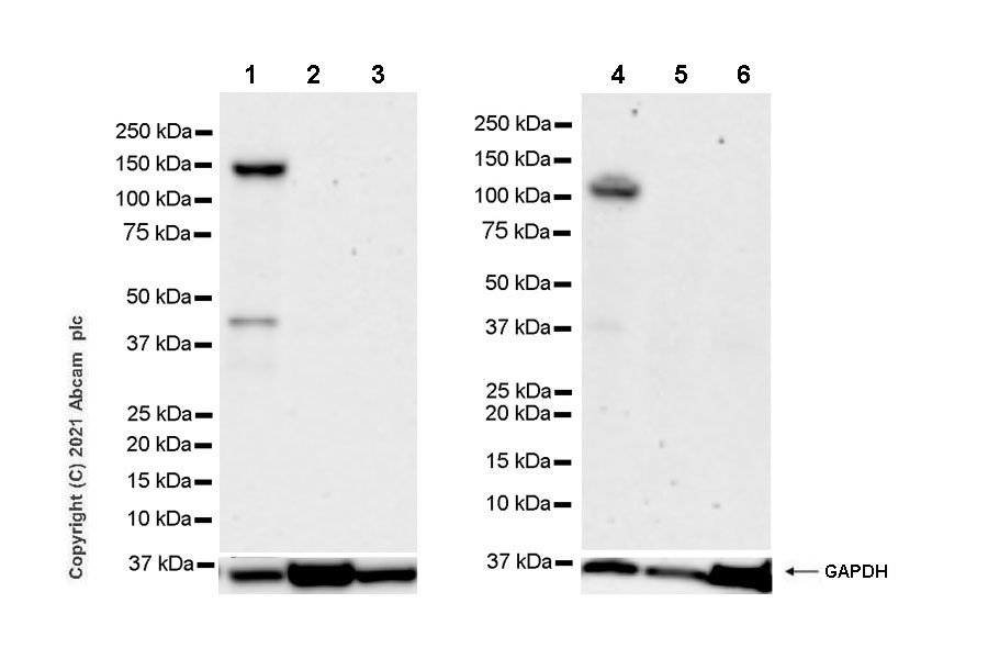 Western blot - Anti-BRDT antibody [EPR25427-24] (AB288435), expandable thumbnail